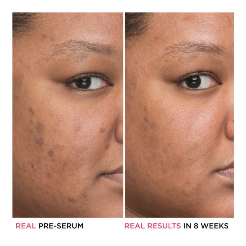Buy IT Cosmetics Bye Bye Dark Spots Niacinamide Serum | Sephora Singapore