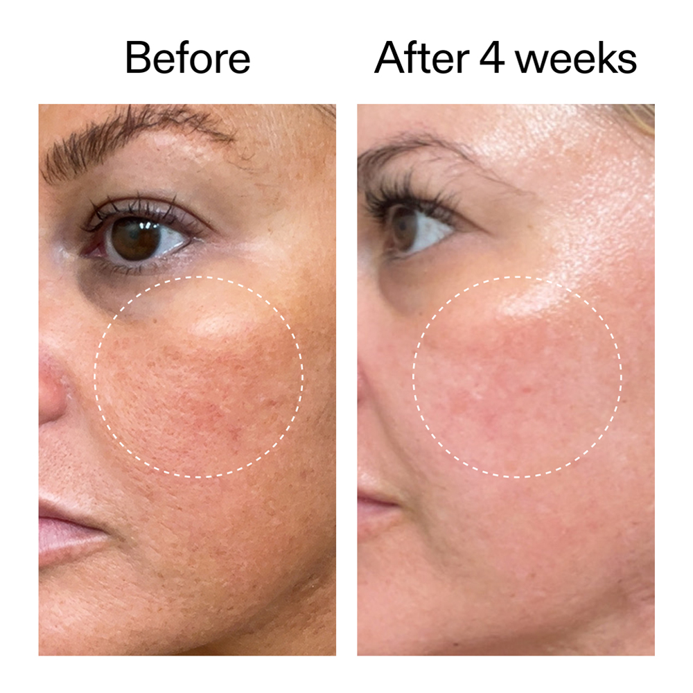 Buy The INKEY List Starter Retinol Serum | Sephora Australia